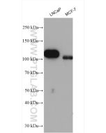 androgen receptor Polyclonal antibody proteintech 22089-1-AP