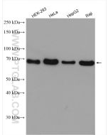 CTP synthase Polyclonal antibody proteintech 15914-1-AP