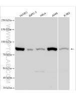 TGM2 Polyclonal antibody proteintech 15100-1-AP