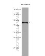 Transferrin/TF Polyclonal antibody proteintech 17435-1-AP