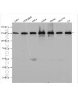 ROCK1 Polyclonal antibody proteintech 21850-1-AP