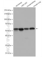 PDIA6 Polyclonal antibody proteintech 18233-1-AP