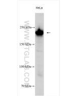 COL4A2 Polyclonal antibody proteintech 55131-1-AP