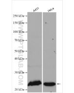 RAB8A Polyclonal antibody proteintech 55296-1-AP