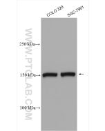 KIAA1199 / CEMIP  Polyclonal antibody proteintech 21129-1-AP