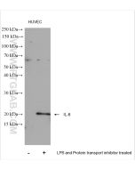 IL-6 Polyclonal antibody proteintech 21865-1-AP