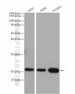 Claudin 1 Polyclonal antibody proteintech 13050-1-AP