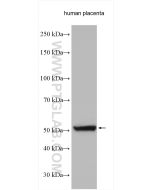 CYP19A1 Polyclonal antibody proteintech 16554-1-AP