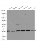 SIRT5 Polyclonal antibody proteintech 15122-1-AP