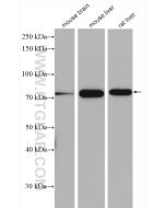 ERp72 Polyclonal antibody proteintech 14712-1-AP