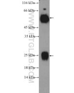 Rabbit Anti-Human IgG Polyclonal antibody proteintech 10284-1-AP