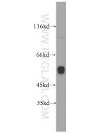 CYP1A2-Specific Polyclonal antibody proteintech 19936-1-AP