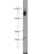 GFPT1 Polyclonal antibody proteintech 14132-1-AP