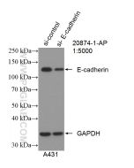 E-cadherin Polyclonal antibody proteintech 20874-1-AP
