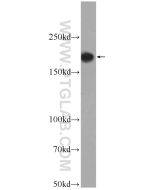 ACE Polyclonal antibody proteintech 24743-1-AP