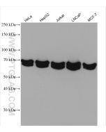 DLAT Polyclonal antibody proteintech 13426-1-AP