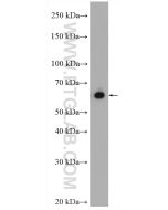 Transketolase Polyclonal antibody proteintech 11039-1-AP