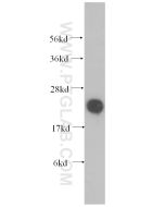 COQ7 Polyclonal antibody proteintech 15083-1-AP