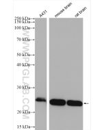 RAB35 Polyclonal antibody proteintech 11329-2-AP