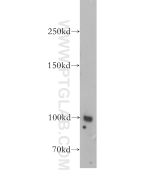 Neprilysin/CD10 Polyclonal antibody proteintech 18008-1-AP