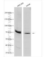 FOXC1 Polyclonal antibody proteintech 30082-1-AP