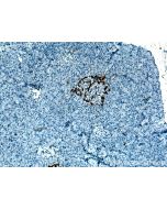 Glucagon Polyclonal antibody proteintech 15954-1-AP