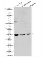 Choline Kinase Alpha Polyclonal antibody proteintech 13520-1-AP
