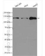 MKL1/MRTF-A Polyclonal antibody proteintech 21166-1-AP