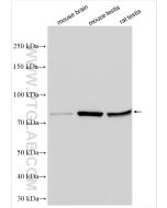 IFT81 Polyclonal antibody proteintech 11744-1-AP