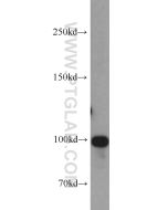 OTUD7B Polyclonal antibody proteintech 16605-1-AP