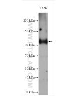 Progesterone Receptor Polyclonal antibody proteintech 25871-1-AP
