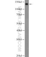 Collagen Type III (N-terminal) Polyclonal antibody proteintech 22734-1-AP