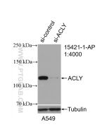 ACLY Polyclonal antibody proteintech 15421-1-AP