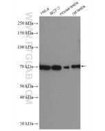 ER Polyclonal antibody proteintech 21244-1-AP