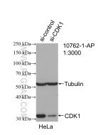 CDK1 Polyclonal antibody proteintech 10762-1-AP