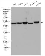 PGD Polyclonal antibody proteintech 14718-1-AP
