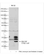 GM-CSF Polyclonal antibody proteintech 17762-1-AP