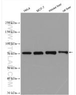 MMP13 Polyclonal antibody proteintech 18165-1-AP