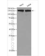 Ataxin 2 Polyclonal antibody proteintech 21776-1-AP