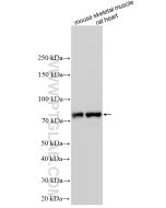 CPT1B-specific Polyclonal antibody proteintech 22170-1-AP