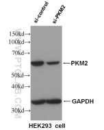 PKM2-specific Polyclonal antibody proteintech 15822-1-AP
