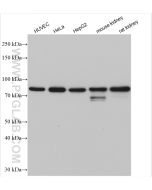 ABCG1 Polyclonal antibody proteintech 13578-1-AP