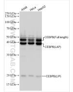 CEBPB Polyclonal antibody proteintech 23431-1-AP