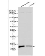 Myosin Light Chain 2/MLC-2V Polyclonal antibody proteintech 10906-1-AP