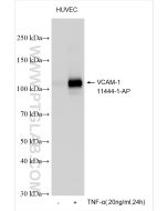 VCAM-1/CD106 Polyclonal antibody proteintech 11444-1-AP