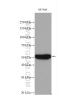 CYP3A4 Polyclonal antibody proteintech 18227-1-AP