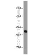 PCNA Polyclonal antibody proteintech 24036-1-AP