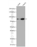PLOD3 Polyclonal antibody proteintech 11027-1-AP