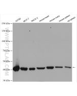 DHODH Polyclonal antibody proteintech 14877-1-AP