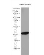 Timp-3 Polyclonal antibody proteintech 10858-1-AP